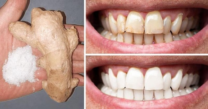 سلامت دهان و دندان به روش گیاهی